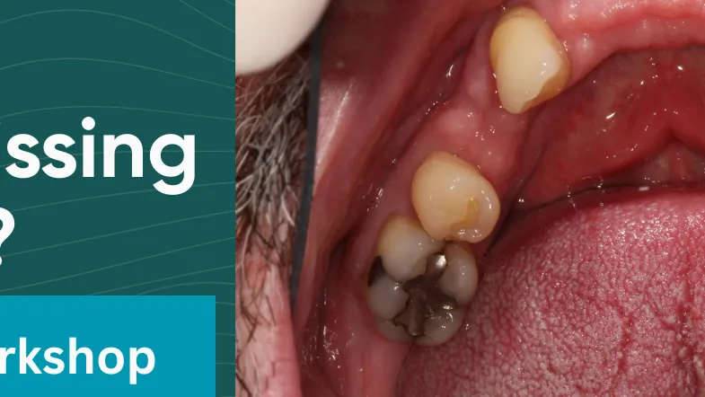 Multiple Missing Teeth FREE Online Workshop about Full Mouth Restoration Options in Brunswick