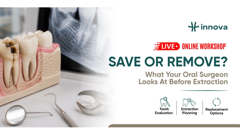 Save or Remove How Oral Surgeons Evaluate a Tooth Before ExtractionAn Interactive Patient Workshop