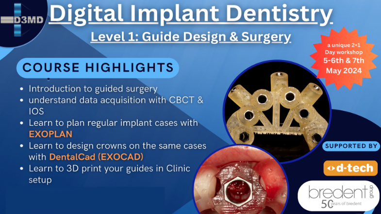 Digital Implant Dentistry