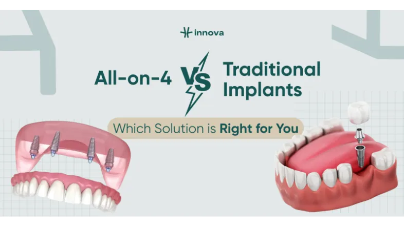 All on 4 vs Traditional Implants Which Solution is Right for You